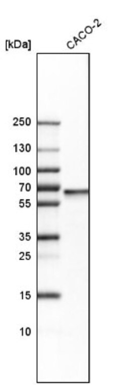 PDP2 Antibody, Novus Biologicals 0.1mL; Unlabeled:Antibodies, Polyclonal